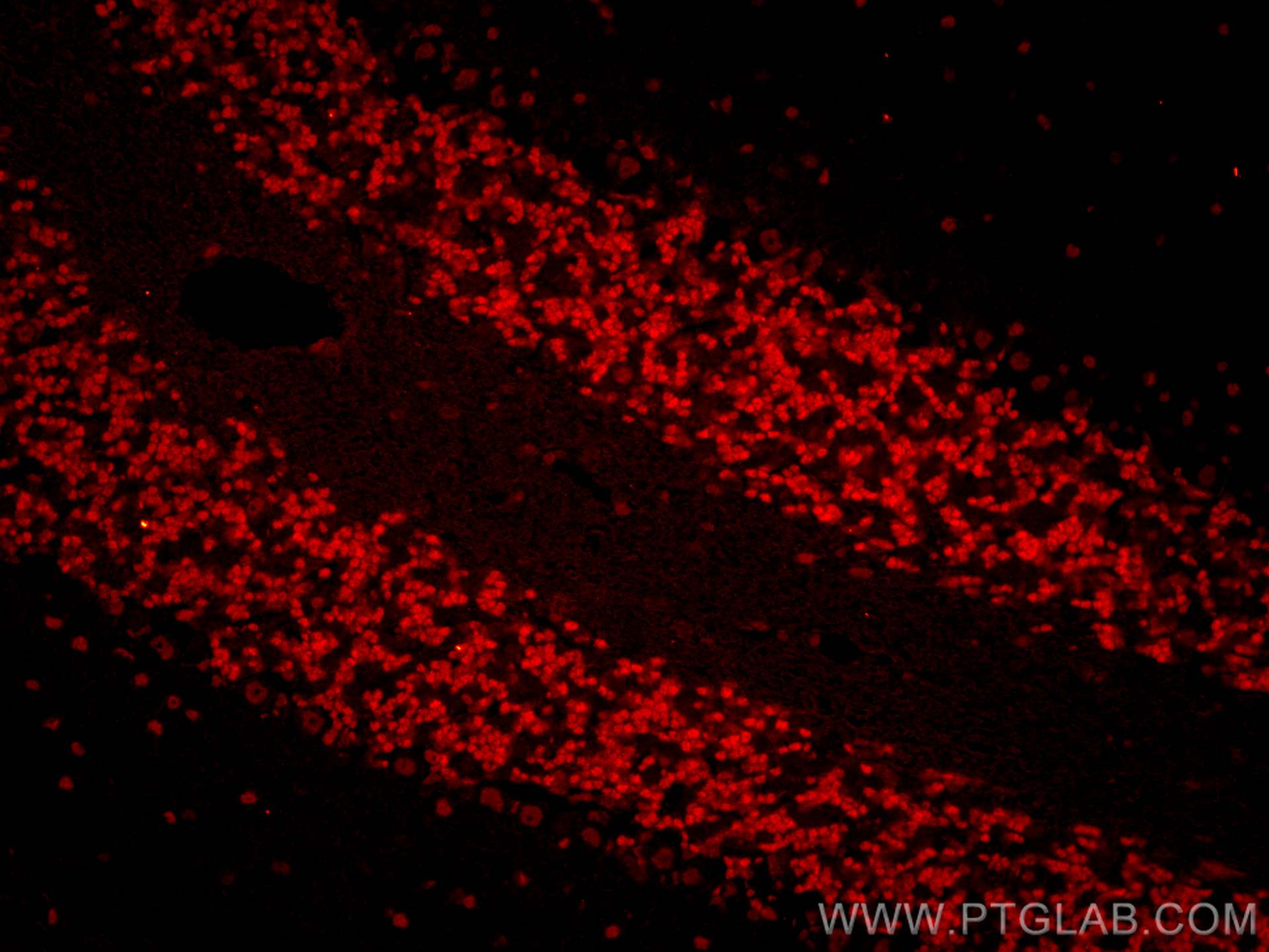 IF Staining of mouse cerebellum using CL594-66836