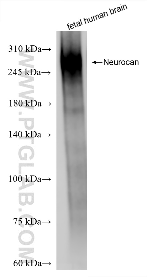 WB analysis of fetal human brain using 86279-1-RR
