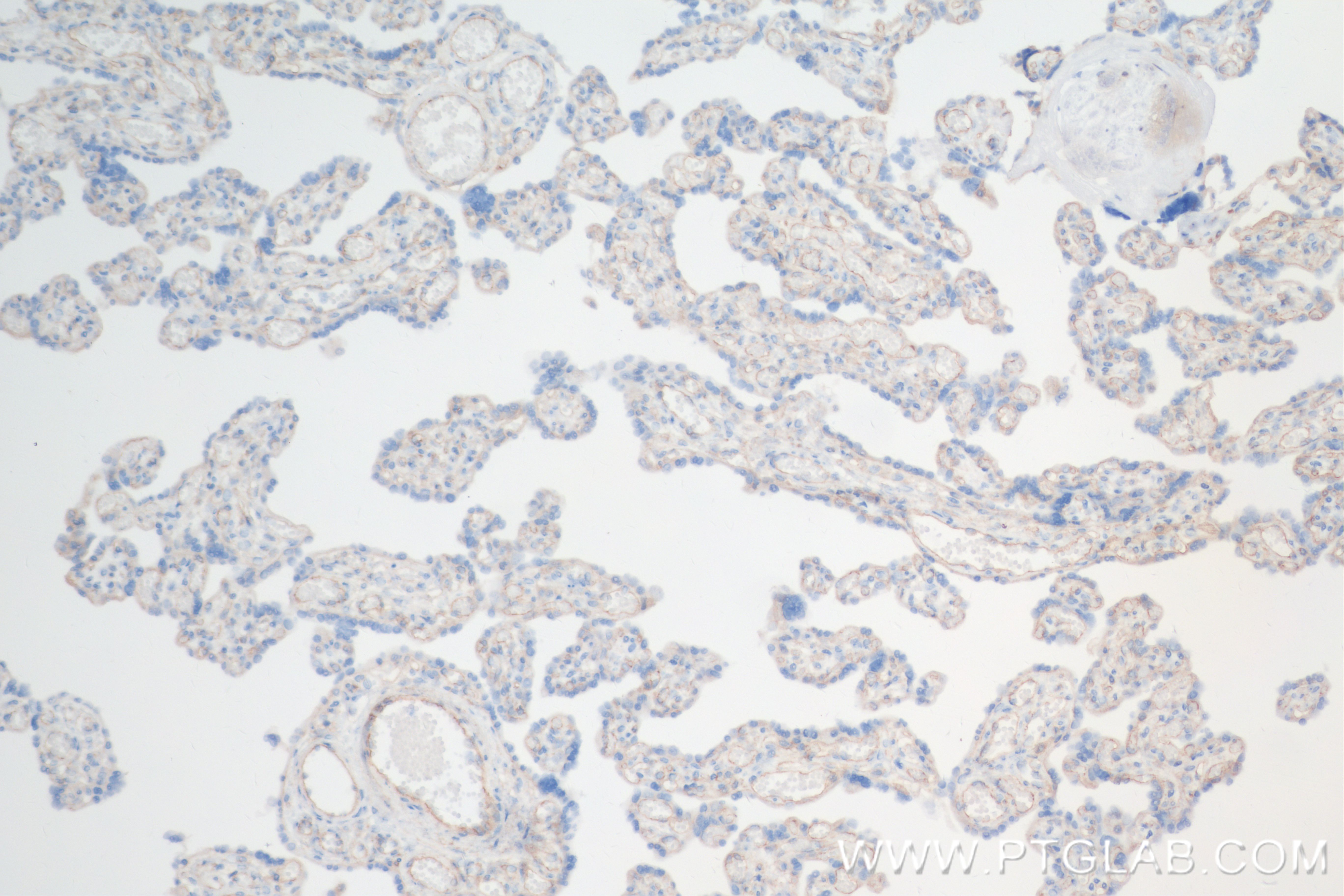 IHC staining of human placenta using 84429-5-RR