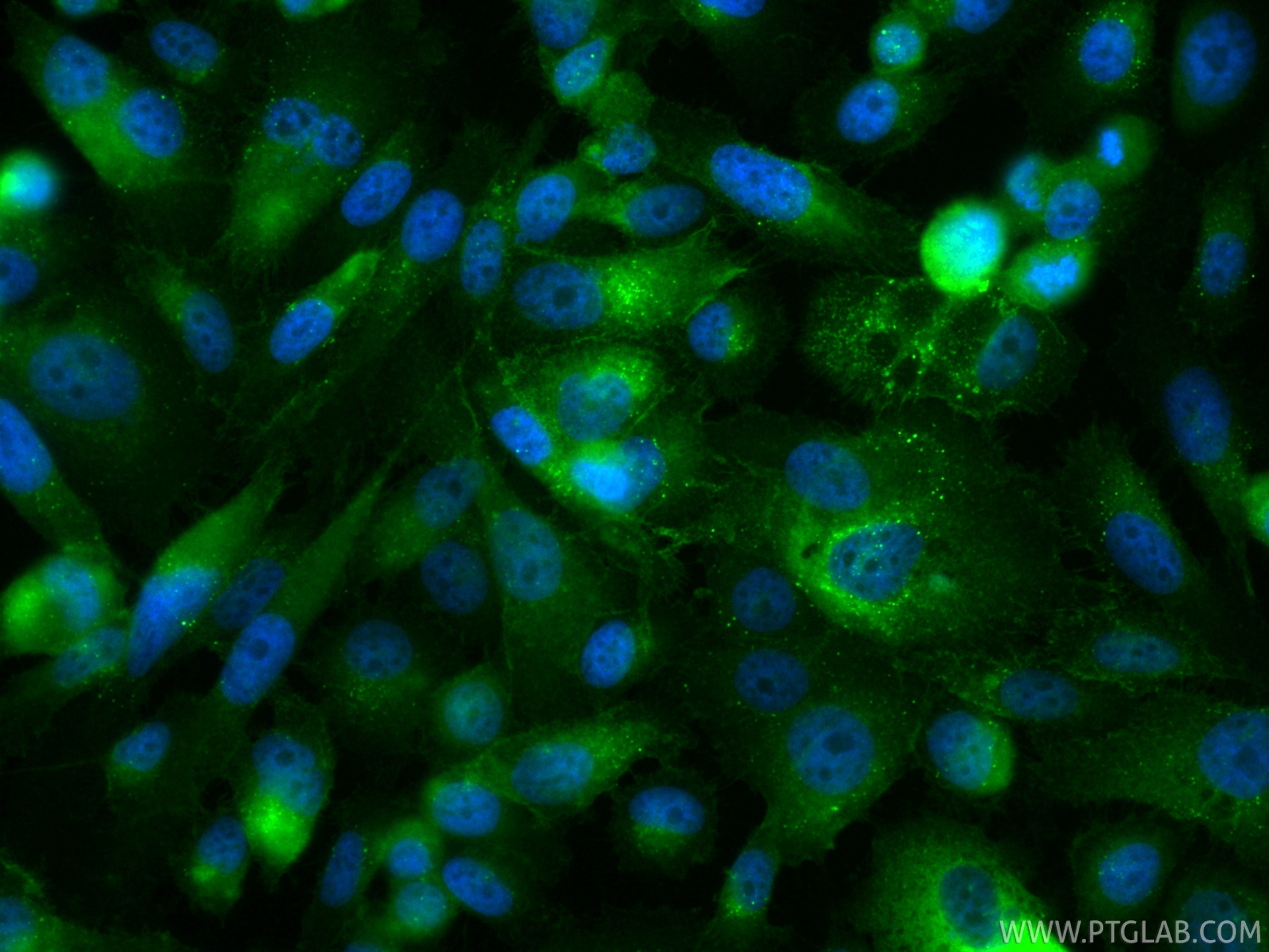 IF Staining of PC-3 using CL488-84429-5 IF Staining of PC-3 using CL488-84429-5