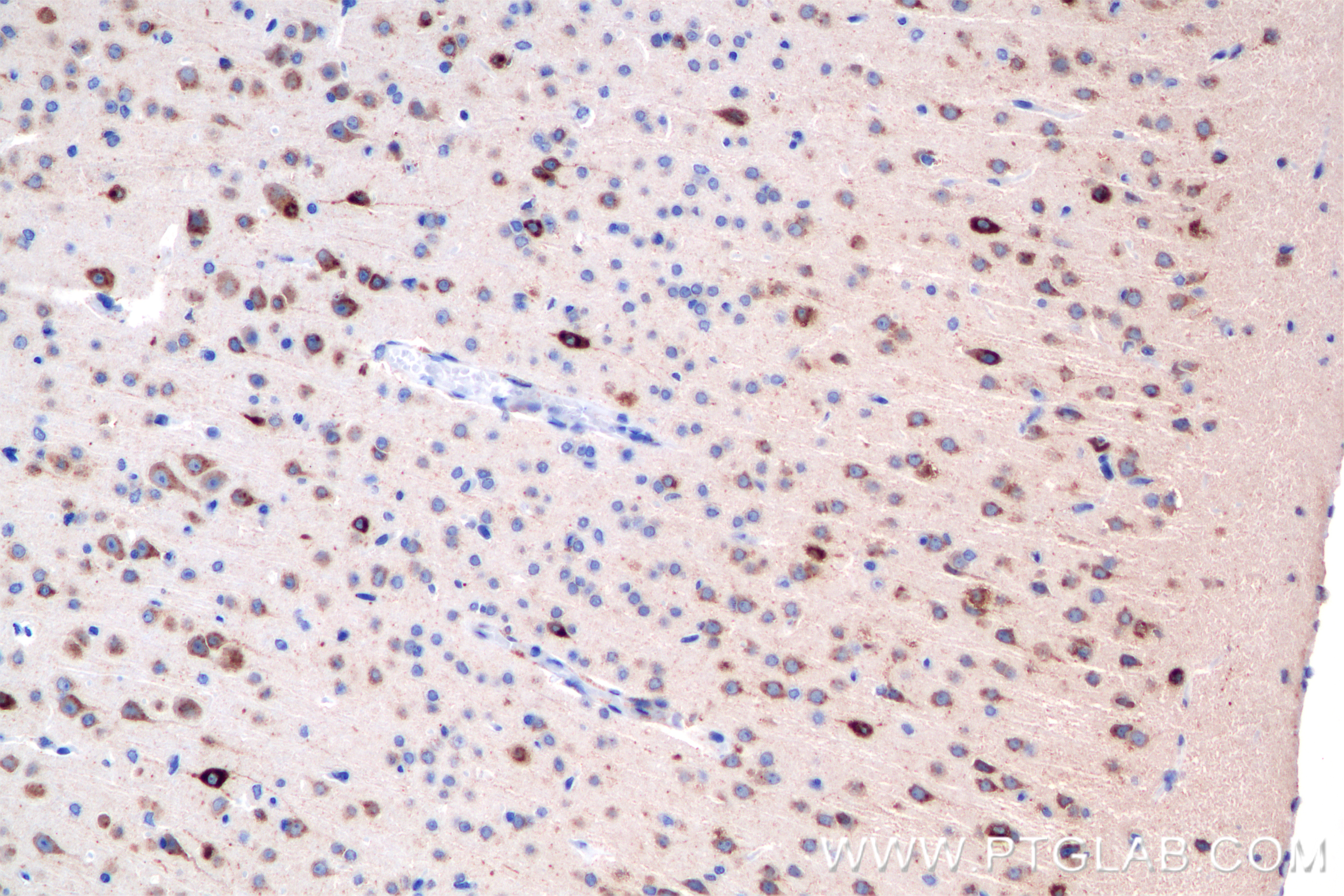 IHC staining of mouse brain using 85923-1-RR (same clone as 85923-1-PBS)