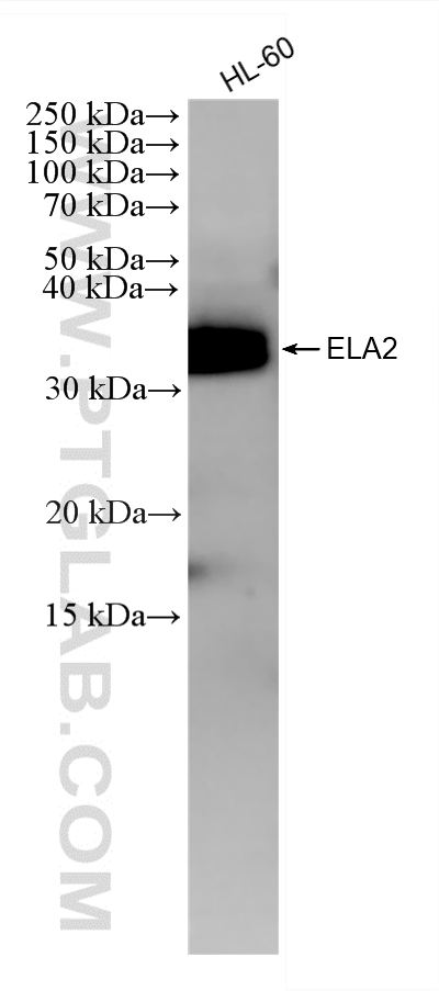 WB analysis of HL-60 using 85965-5-RR WB analysis of HL-60 using 85965-5-RR
