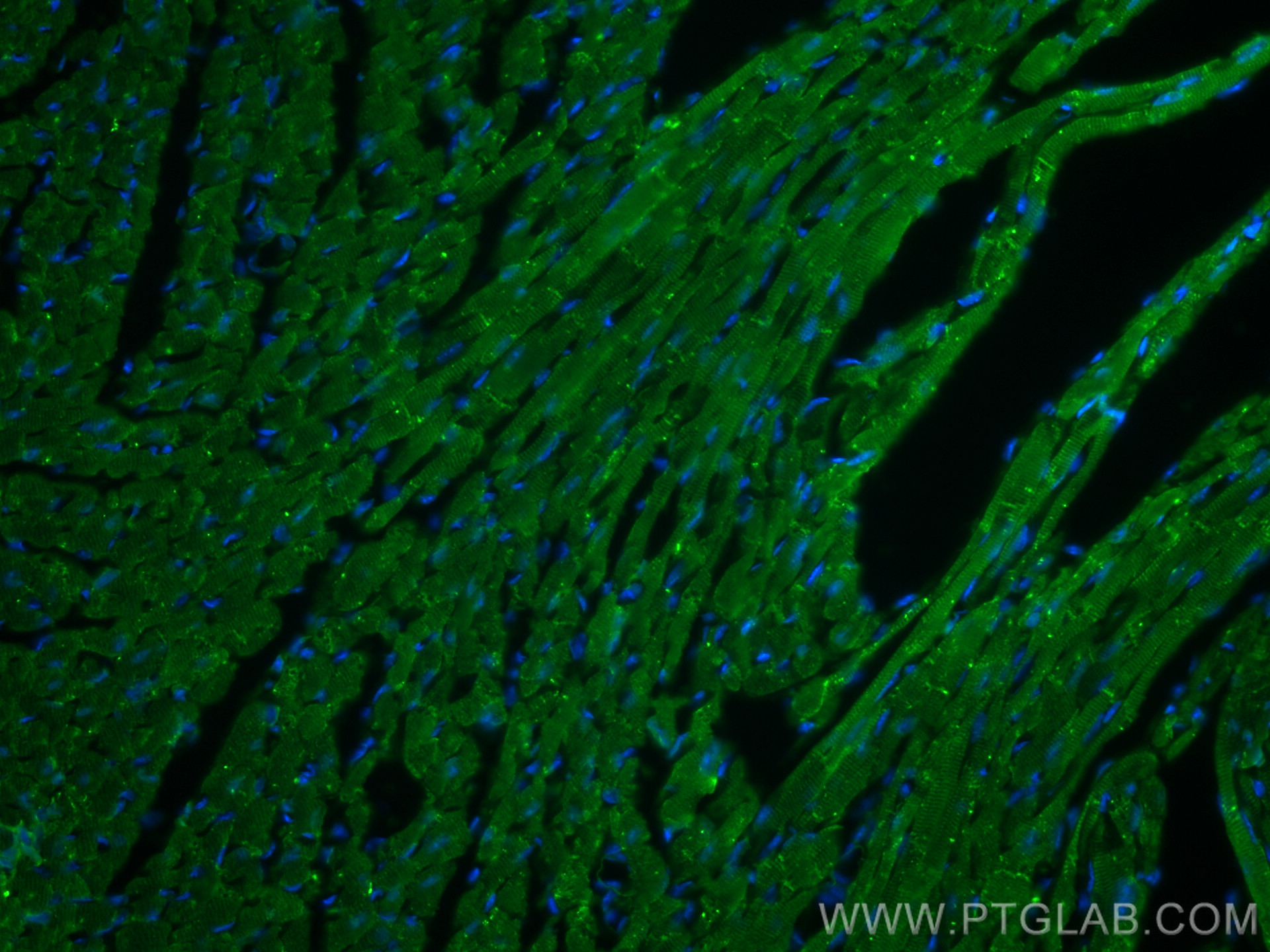 IF Staining of mouse heart using 27737-1-AP