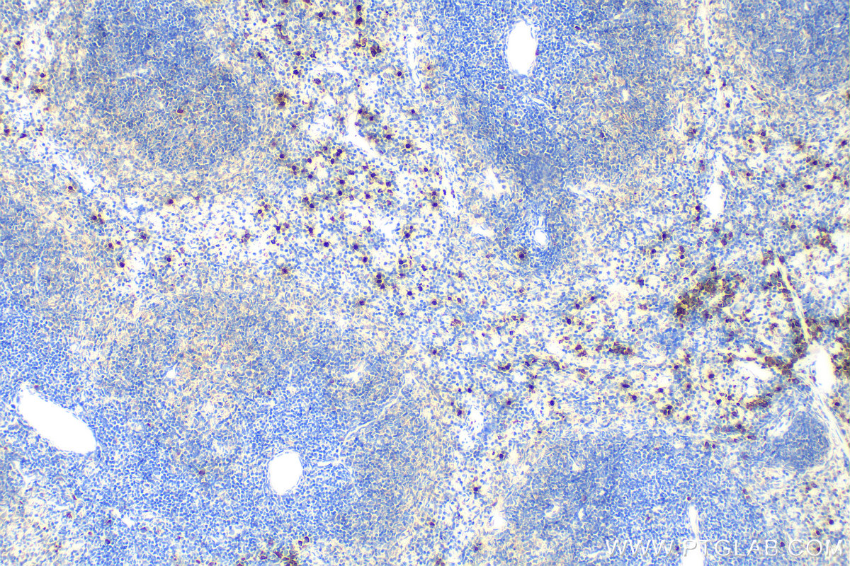 IHC staining of mouse spleen using 30576-1-AP