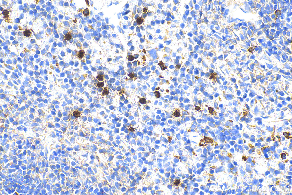 IHC staining of mouse spleen using 30576-1-AP