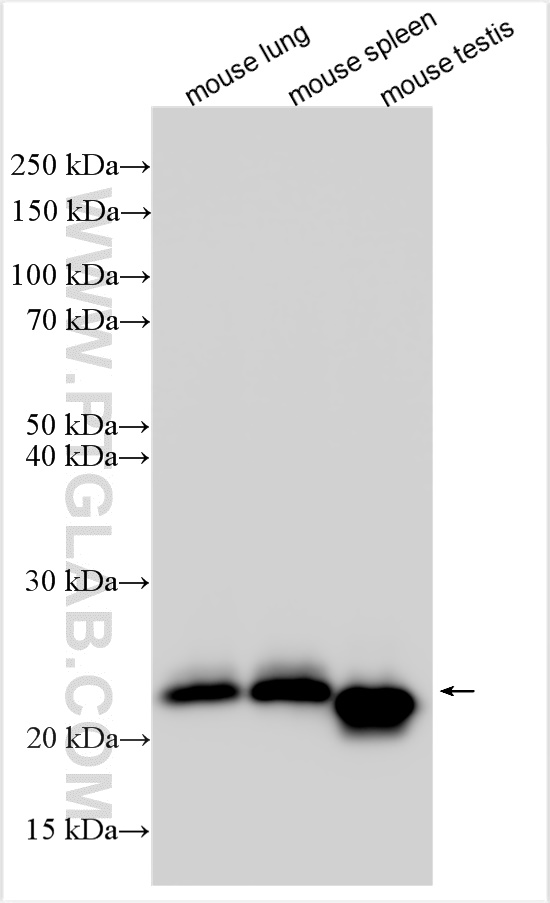 WB analysis of mouse lung using 30576-1-AP