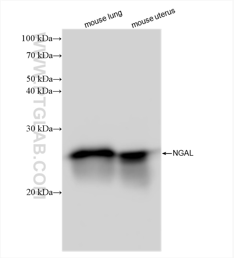 WB analysis using 83102-1-RR