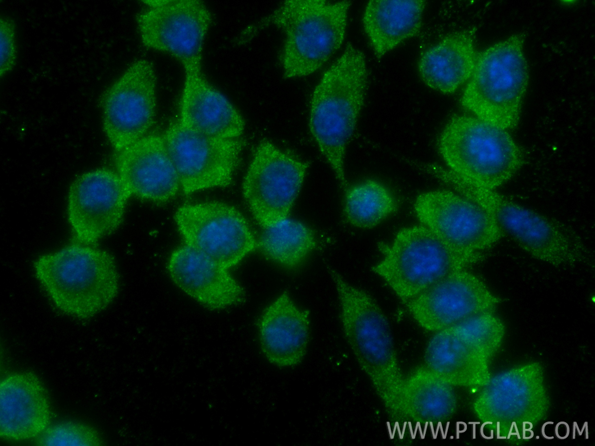 IF Staining of RAW 264.7 using 30109-1-AP