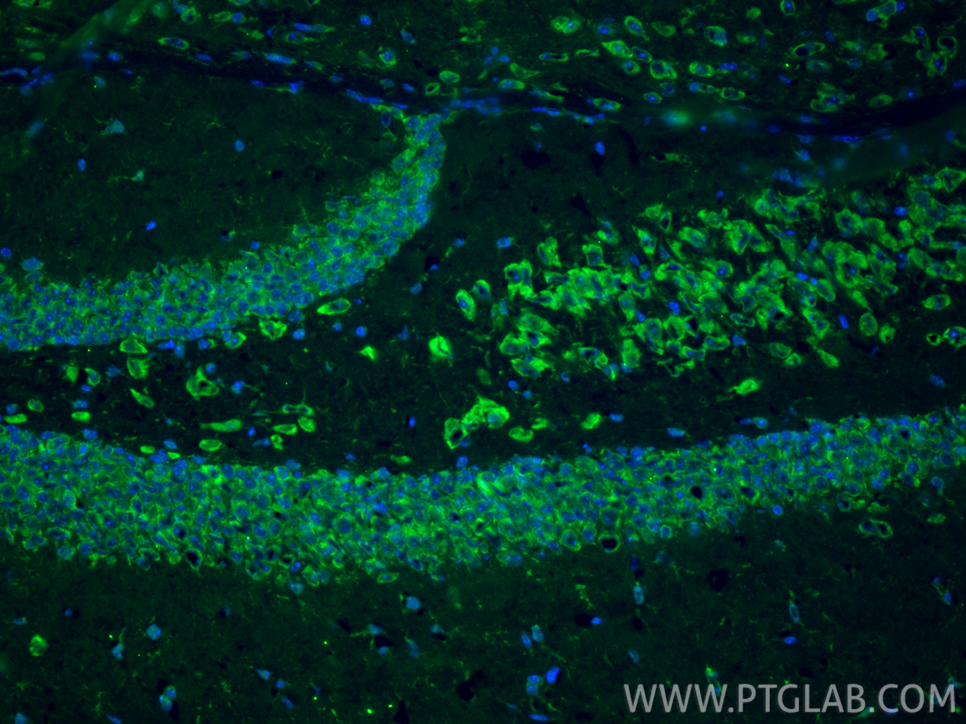 IF Staining of mouse brain using 10062-2-AP IF Staining of mouse brain using 10062-2-AP