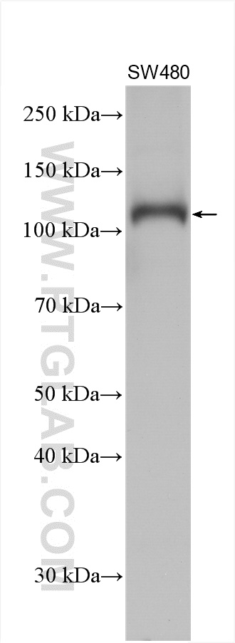 Various lysates were subjected to SDS PAGE followed by western blot with 10062-2-AP (Notch1 antibody) at dilution of 1:4000 incubated at room temperature for 1.5 hours. WB analysis using 10062-2-AP