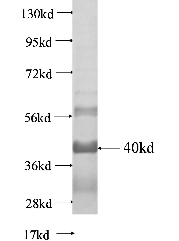 Nphs1 fusion protein Ag0643 SDS-PAGE