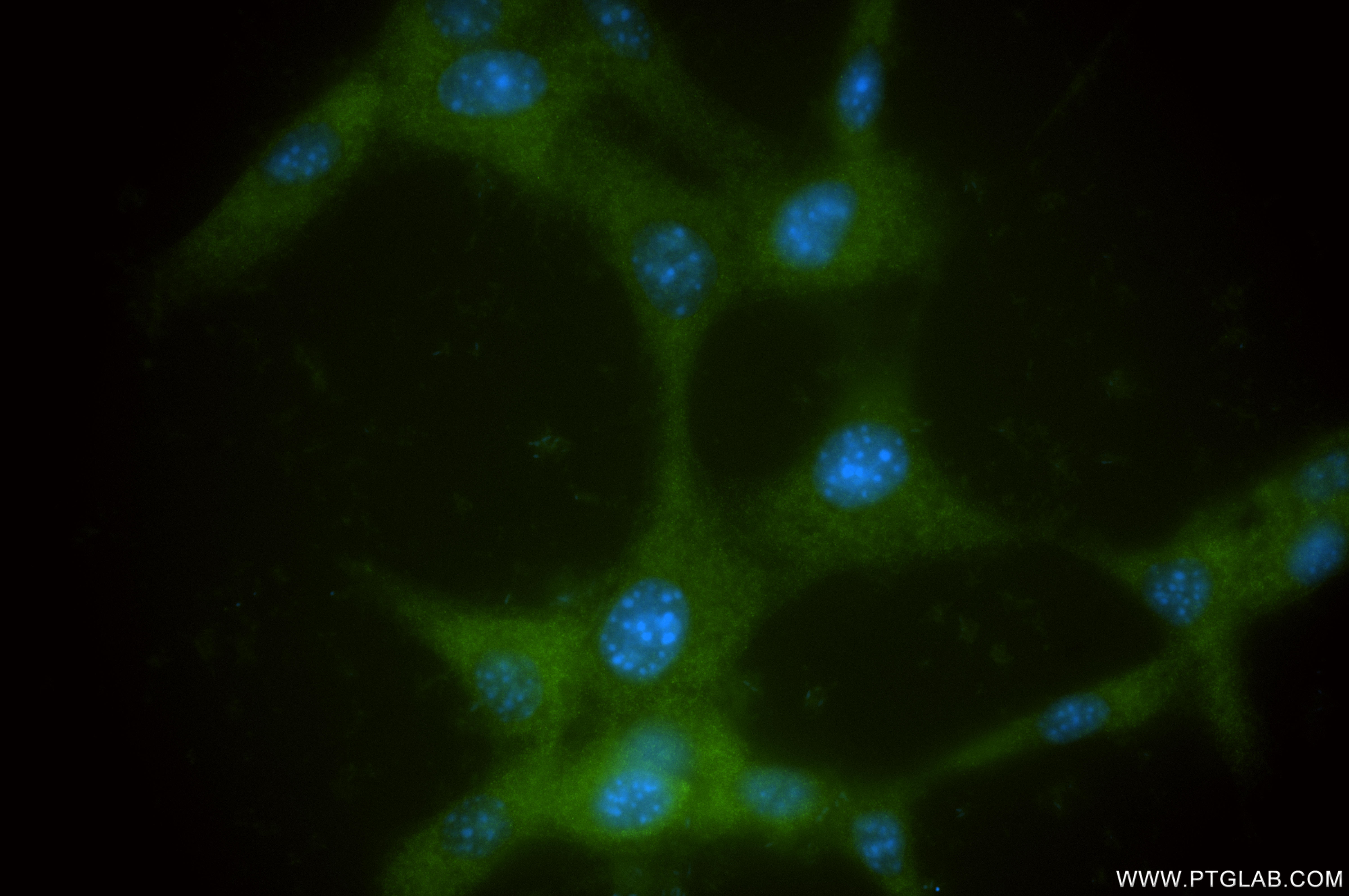 IF Staining of NIH/3T3 using 86651-1-RR