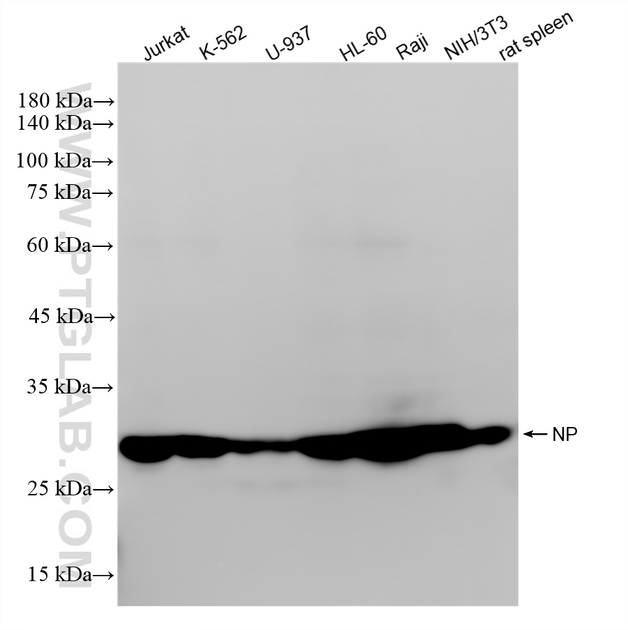 WB analysis using 86651-1-RR