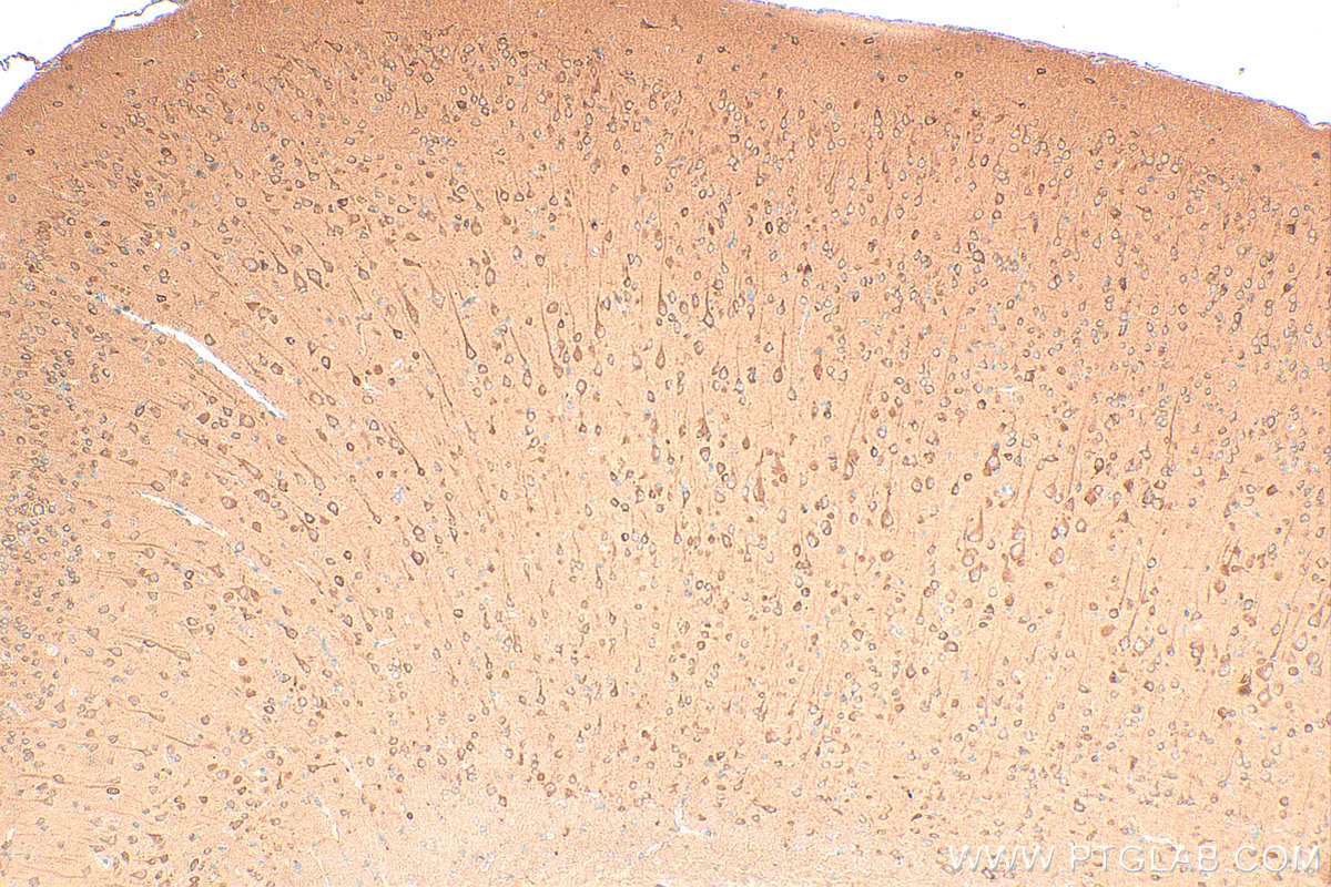 IHC staining of mouse brain using 11764-1-AP IHC staining of mouse brain using 11764-1-AP