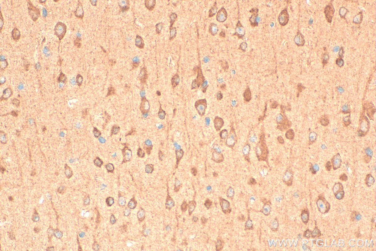IHC staining of mouse brain using 11764-1-AP IHC staining of mouse brain using 11764-1-AP