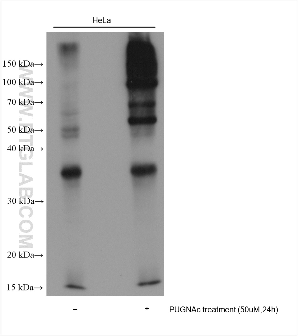 WB analysis using 65292-1-Ig