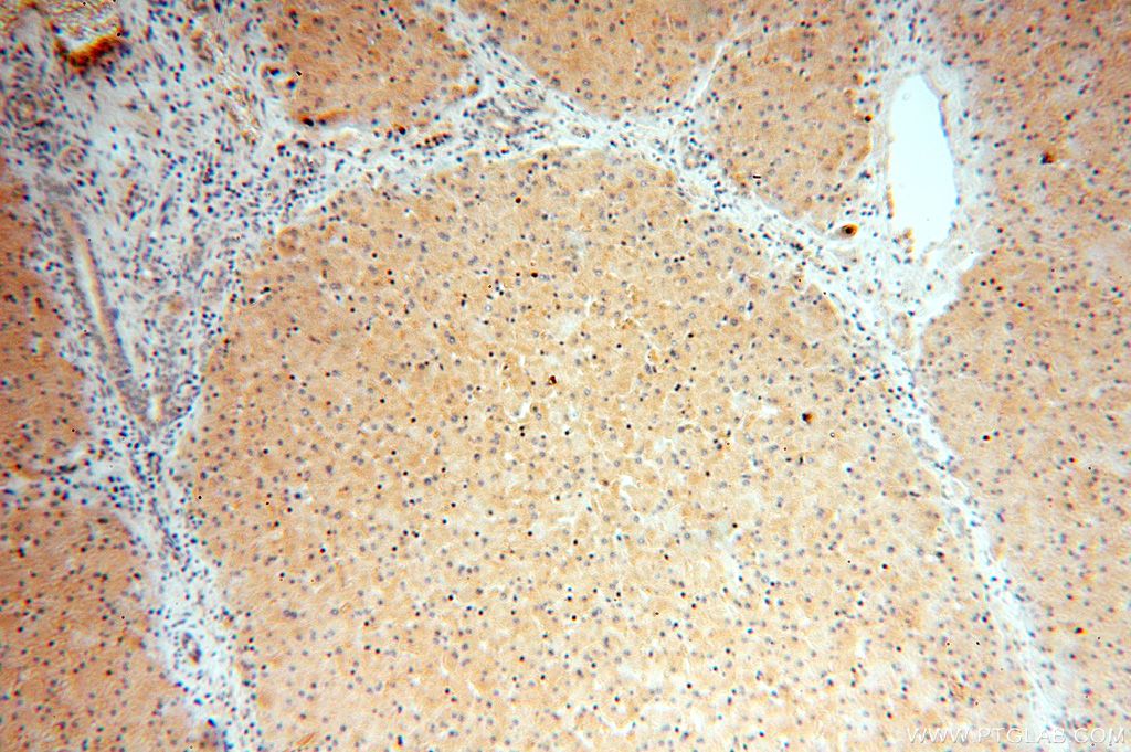 OAS1/3 Polyclonal antibody