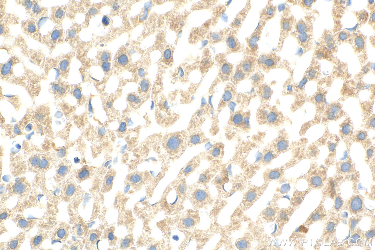 IHC staining of mouse liver using 82883-1-RR