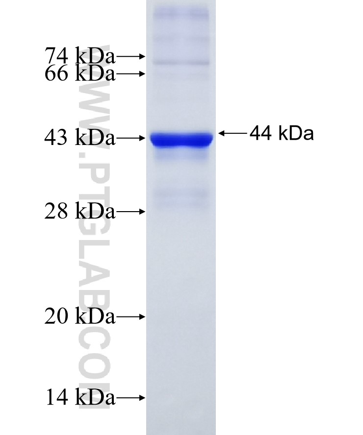 OAS2 fusion protein Ag6170 SDS-PAGE