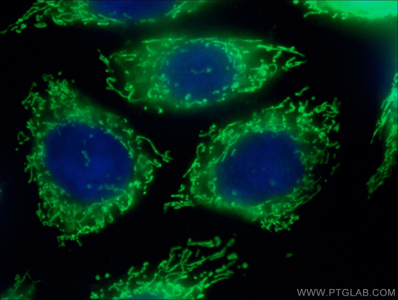 IF Staining of HepG2 using 17089-1-AP