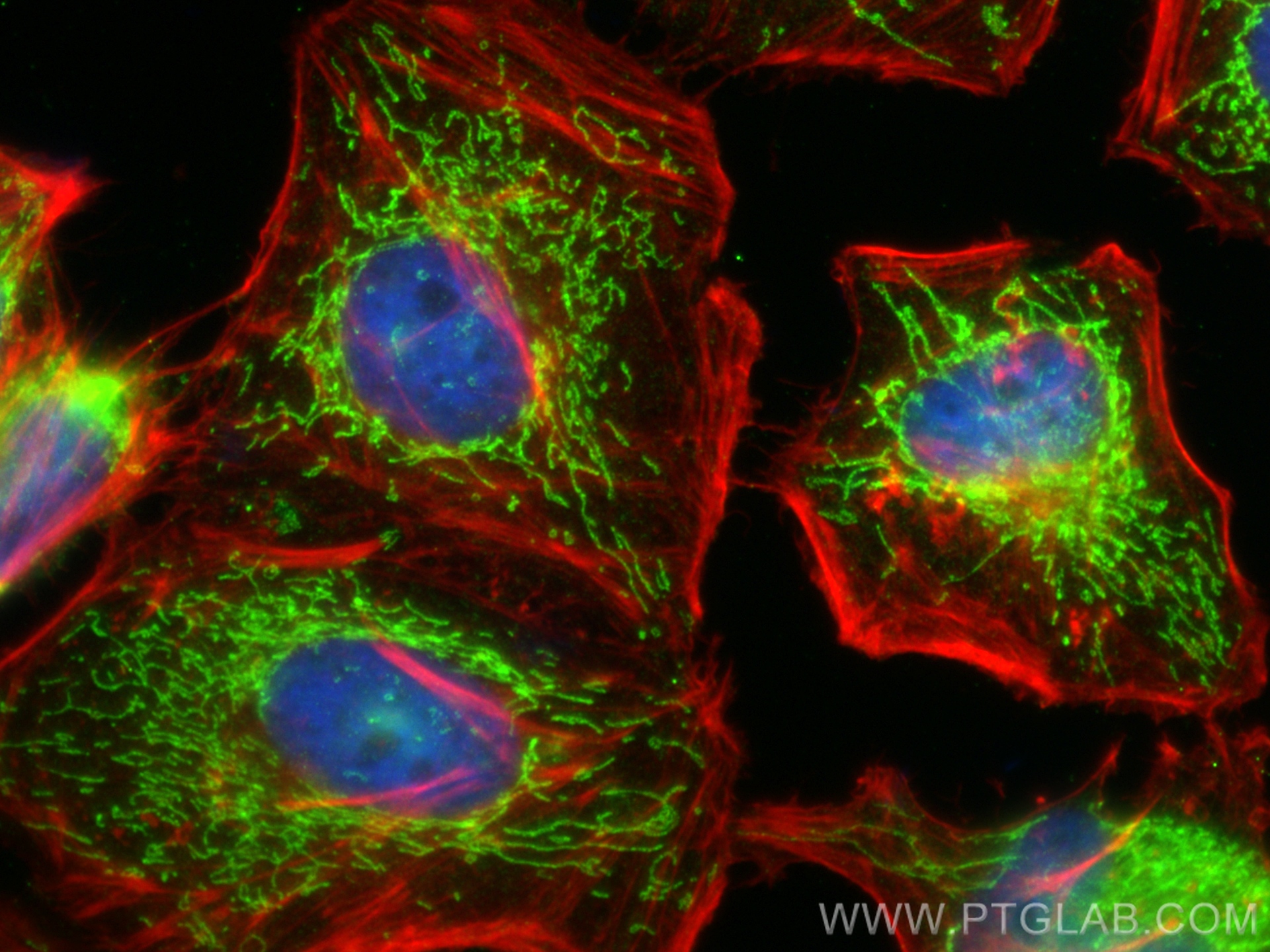 IF Staining of HeLa using 17089-1-AP