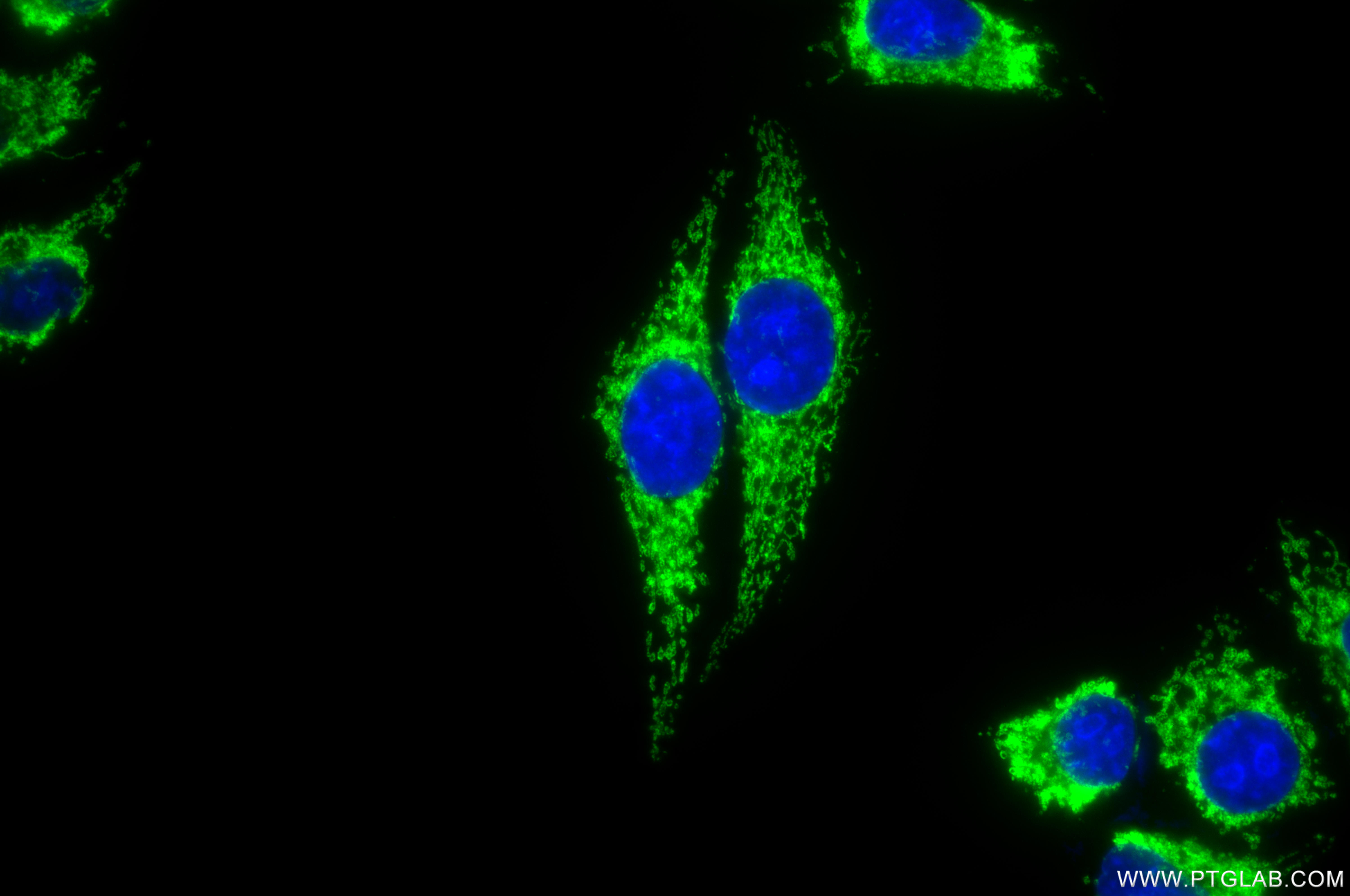 Immunofluorescent analysis of (-20°C Methanol) fixed HepG2 cells using OAT antibody (85218-2-RR, Clone: 242843D8 ) at dilution of 1:500 and CoraLite®488-Conjugated Goat Anti-Rabbit IgG(H+L) (<a class='green' href='/productredirect?CatalogNo=SA00013-2' target='_blank'>SA00013-2</a>). IF Staining of HepG2 using 85218-2-RR