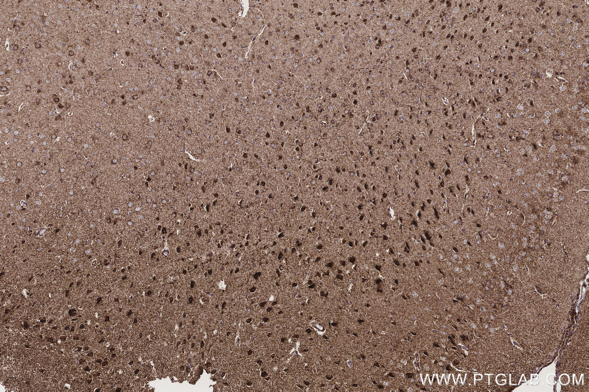 IHC staining of mouse brain using 85218-2-RR IHC staining of mouse brain using 85218-2-RR