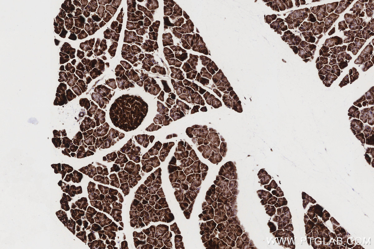 IHC staining of mouse pancreas using 85218-2-RR IHC staining of mouse pancreas using 85218-2-RR