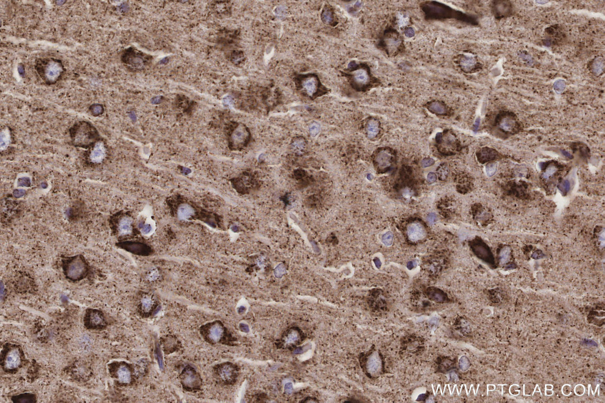 IHC staining of rat brain using 85218-2-RR IHC staining of rat brain using 85218-2-RR