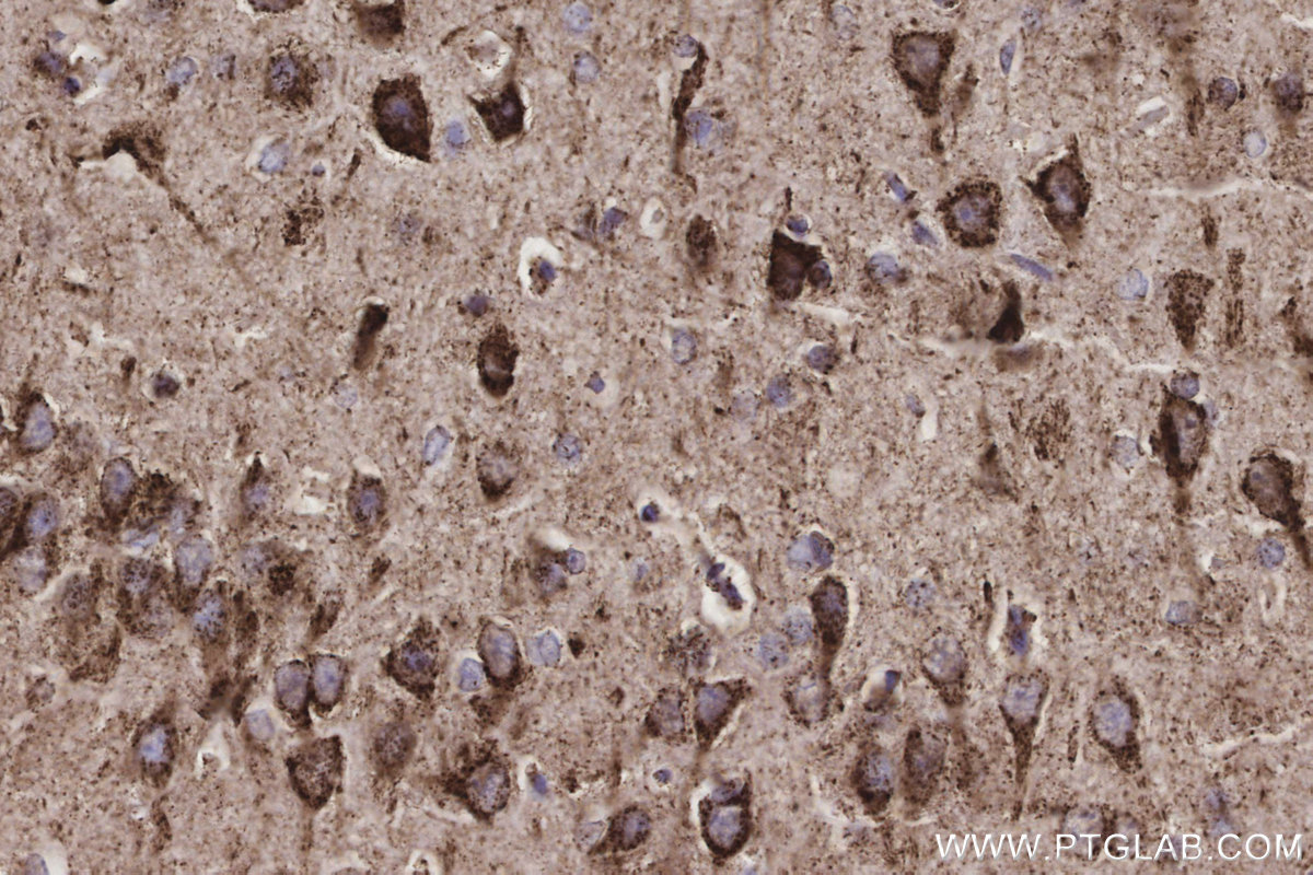 IHC staining of rat brain using 85218-2-RR IHC staining of rat brain using 85218-2-RR