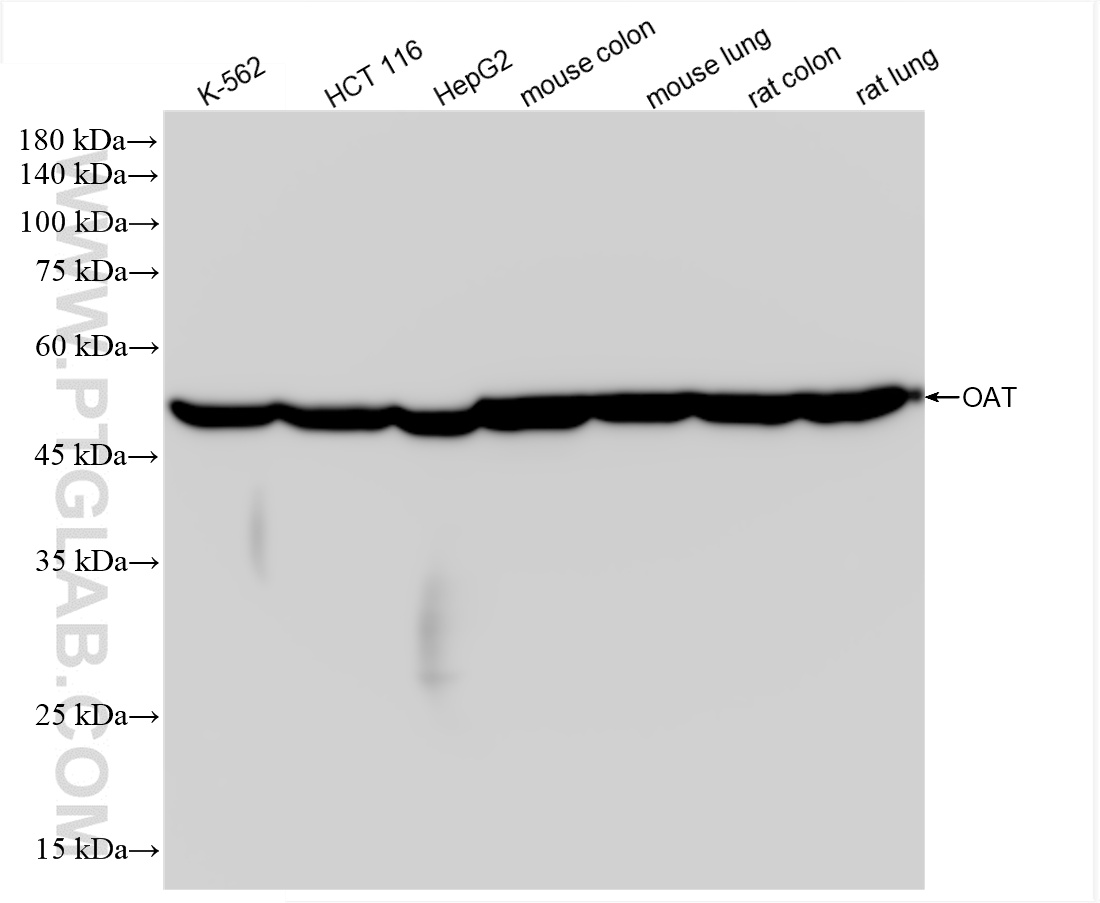 WB analysis using 85218-2-RR (same clone as 85218-2-PBS)