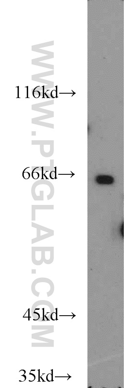 WB analysis of PC-3 using 17163-1-AP