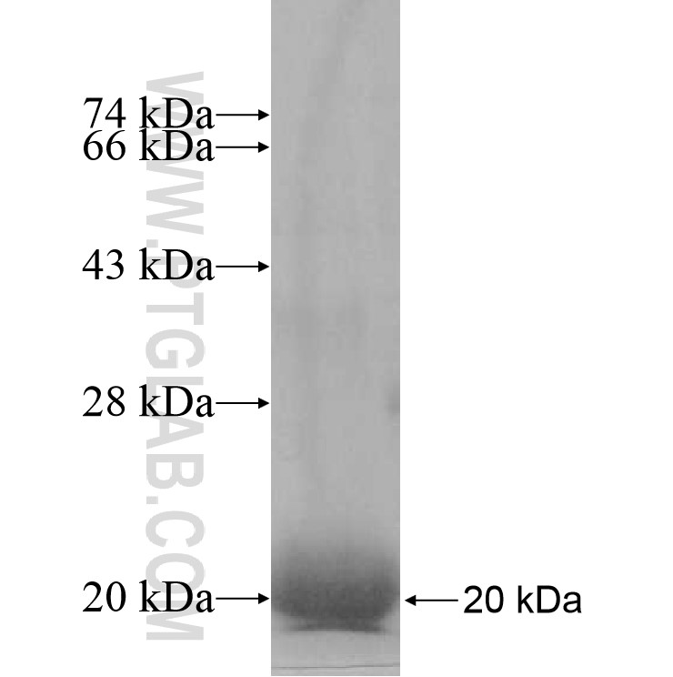 OBFC2A fusion protein Ag10383 SDS-PAGE OBFC2A fusion protein Ag10383 SDS-PAGE