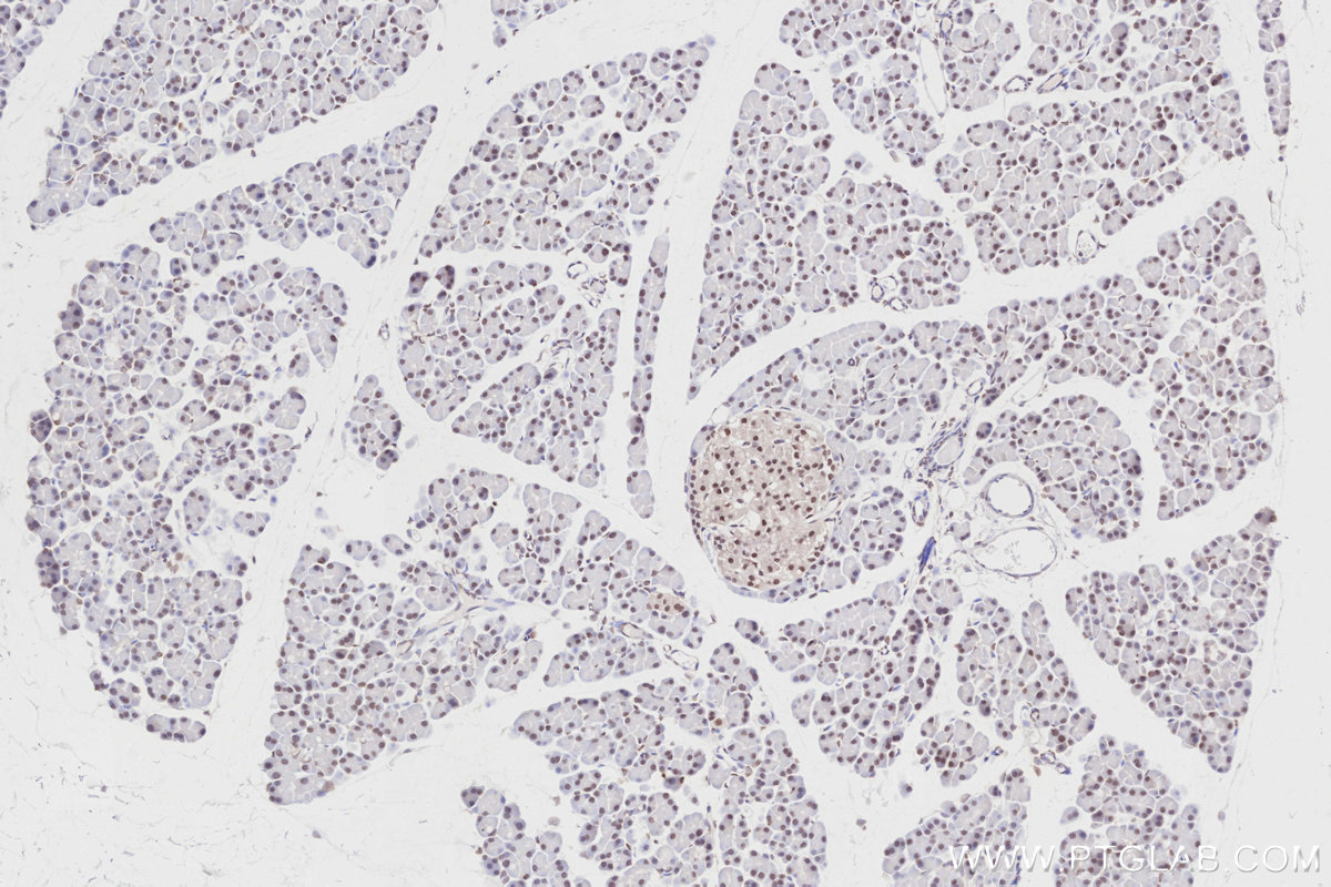 IHC staining of rat pancreas using 14809-1-AP IHC staining of rat pancreas using 14809-1-AP