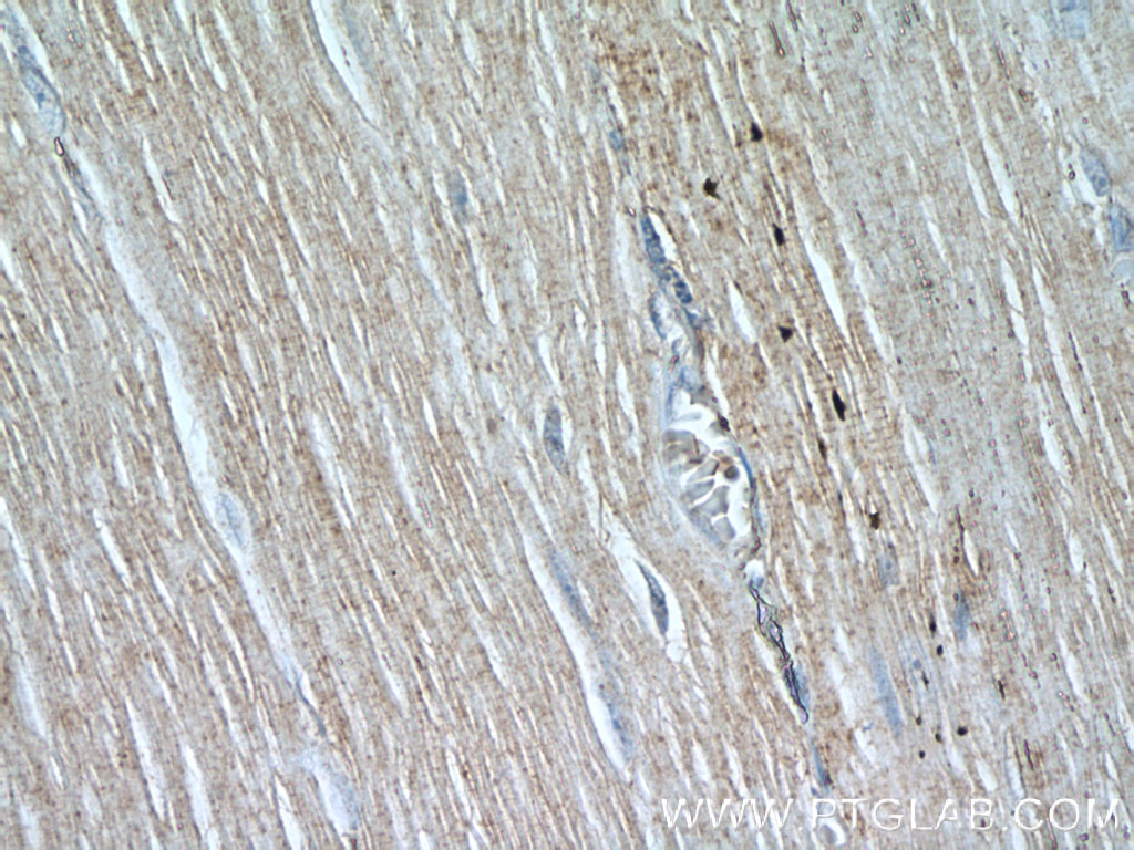 IHC staining of human skeletal muscle using 55281-1-AP