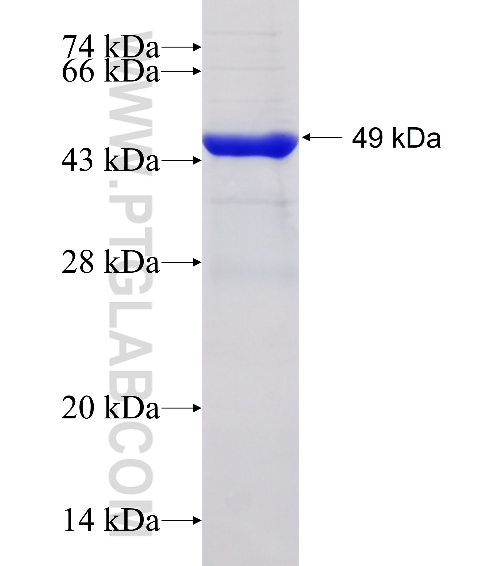 OBSL1 fusion protein Ag31774 SDS-PAGE