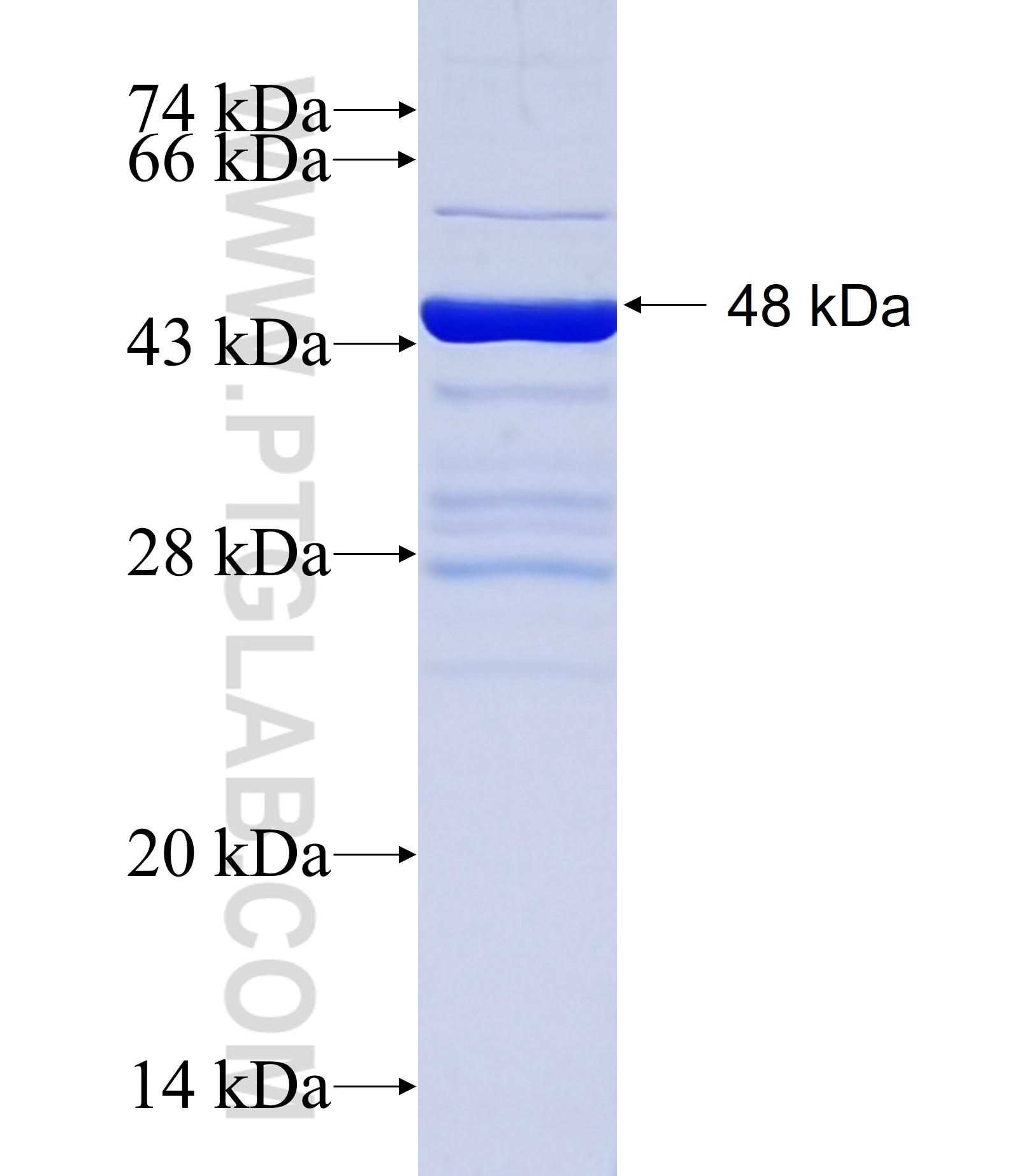 OCA2 fusion protein Ag24864 SDS-PAGE