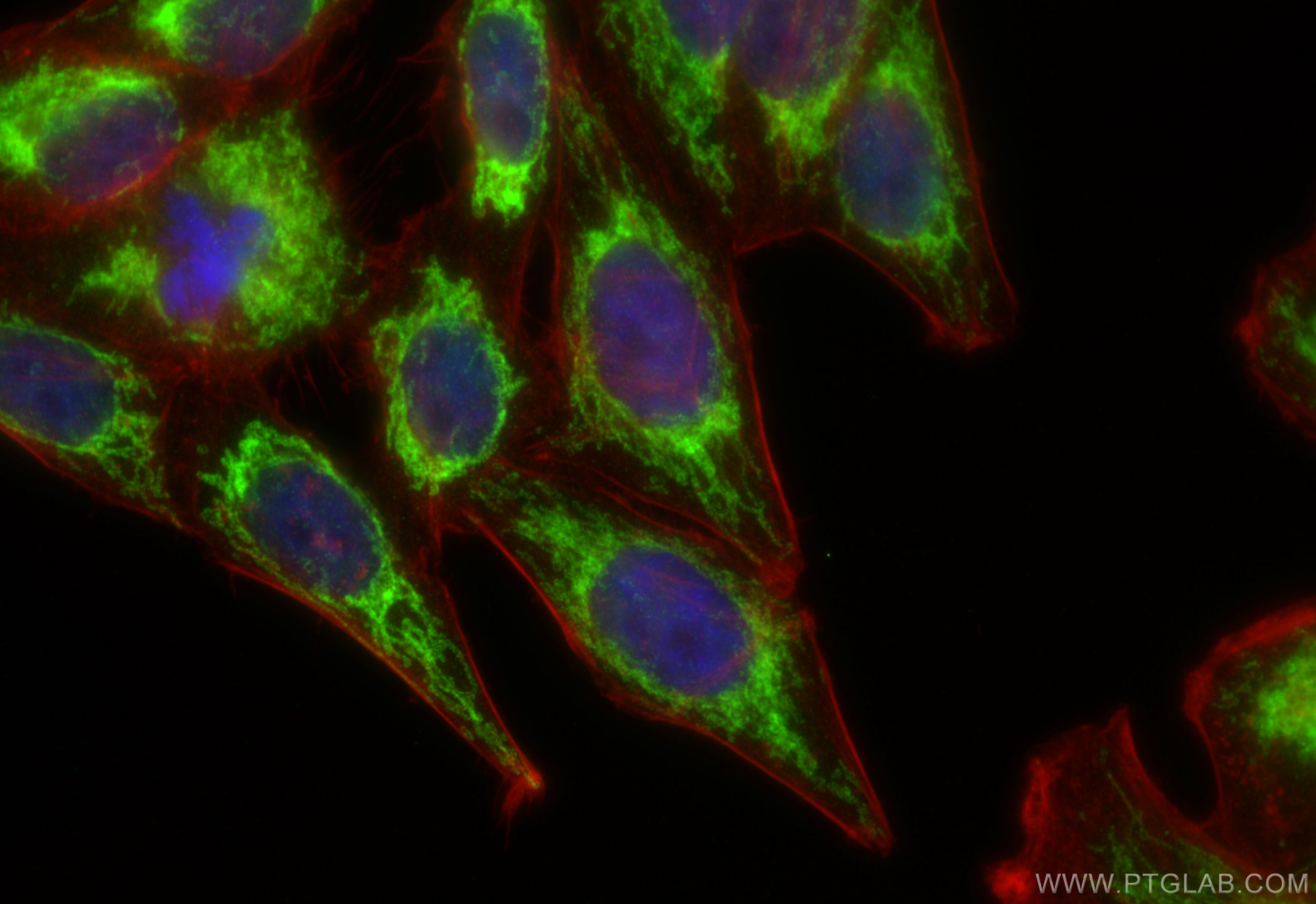 IF Staining of HepG2 using 16634-1-AP