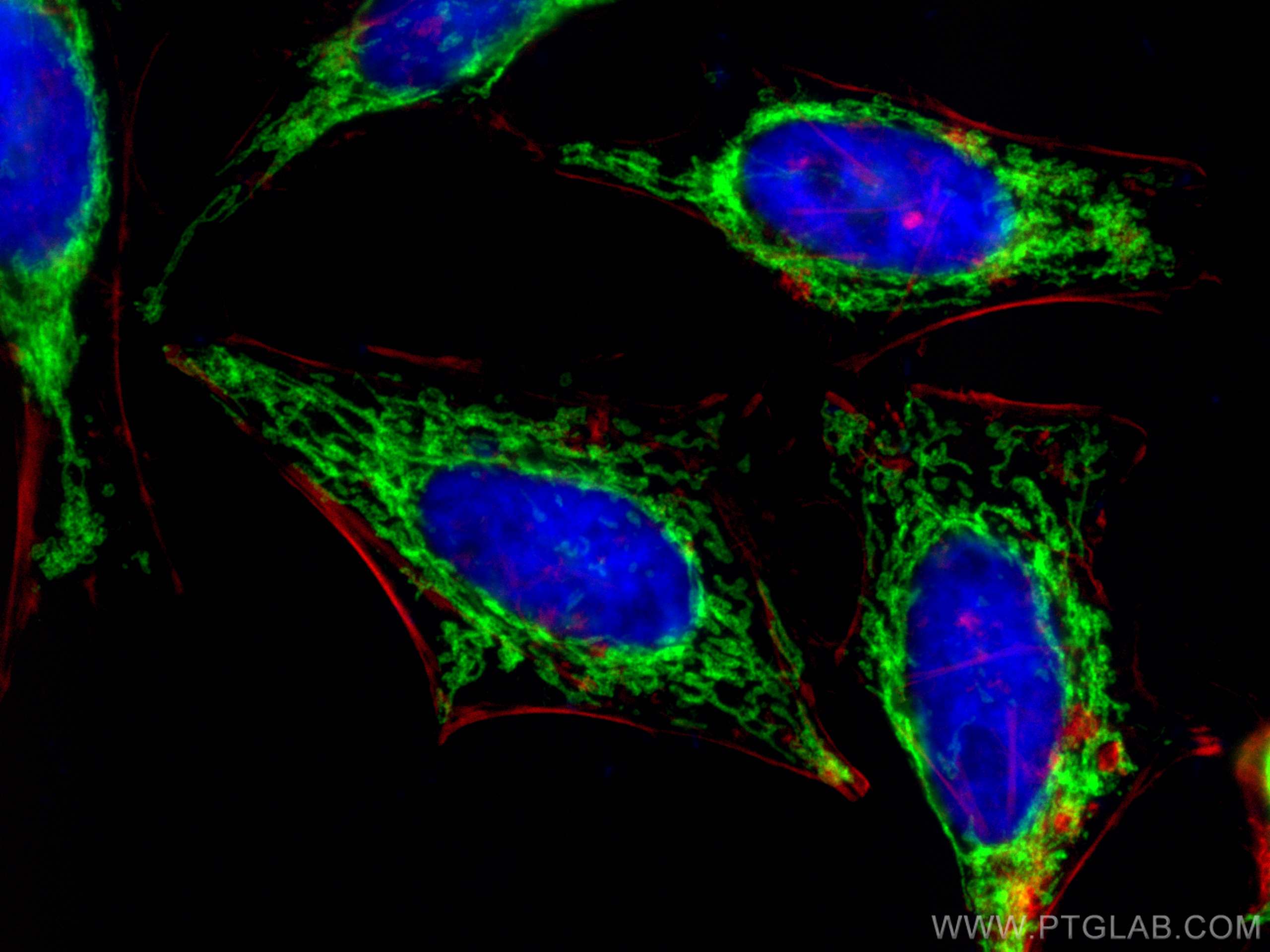 IF Staining of HeLa using 66698-1-Ig