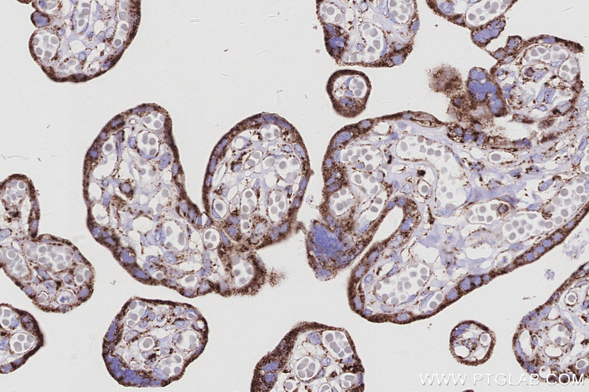 IHC staining of human placenta using 66698-1-Ig