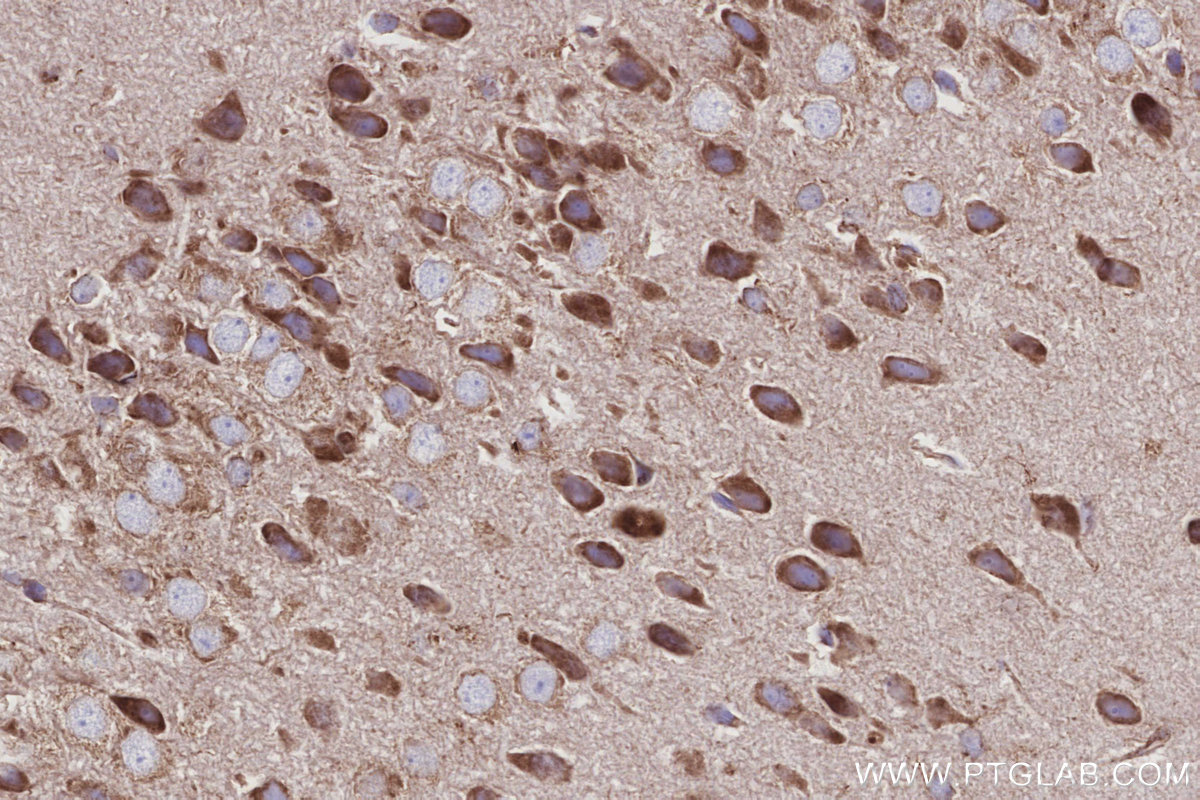 IHC staining of mouse brain using 66698-1-Ig