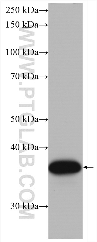 WB analysis of HeLa using 66698-1-Ig