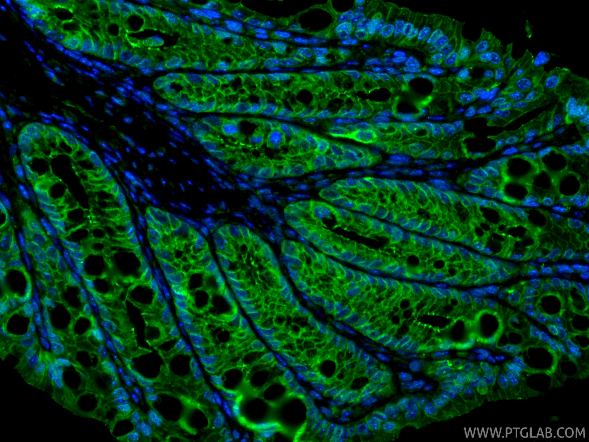 IF Staining of mouse colon using 13409-1-AP