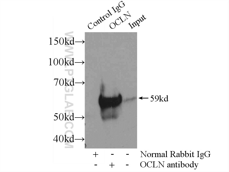 IP experiment of mouse liver using 13409-1-AP (same clone as 13409-1-PBS)