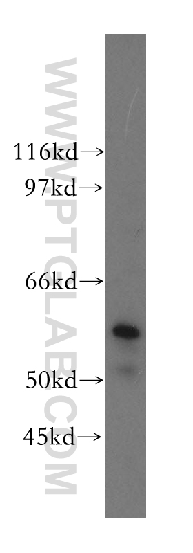 Occludin Polyclonal antibody