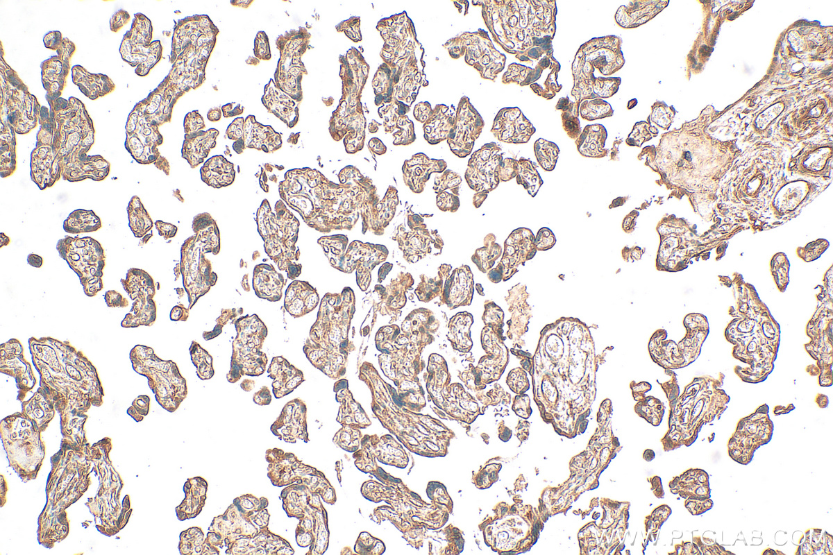 IHC staining of human placenta using 21650-1-AP (same clone as 21650-1-PBS)