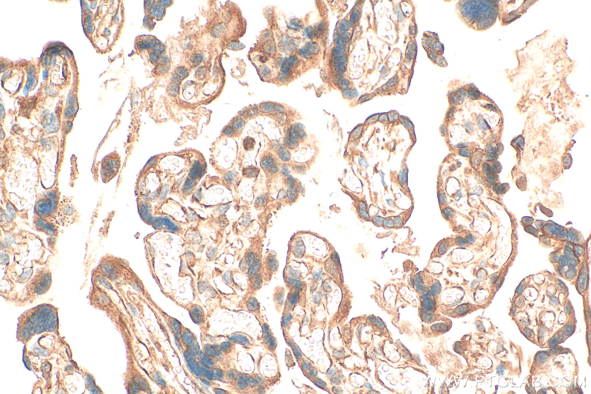 IHC staining of human placenta using 21650-1-AP (same clone as 21650-1-PBS)