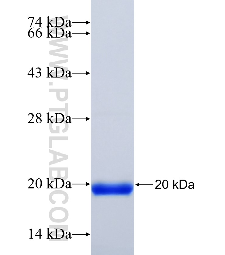 OCM2 fusion protein Ag35909 SDS-PAGE OCM2 fusion protein Ag35909 SDS-PAGE