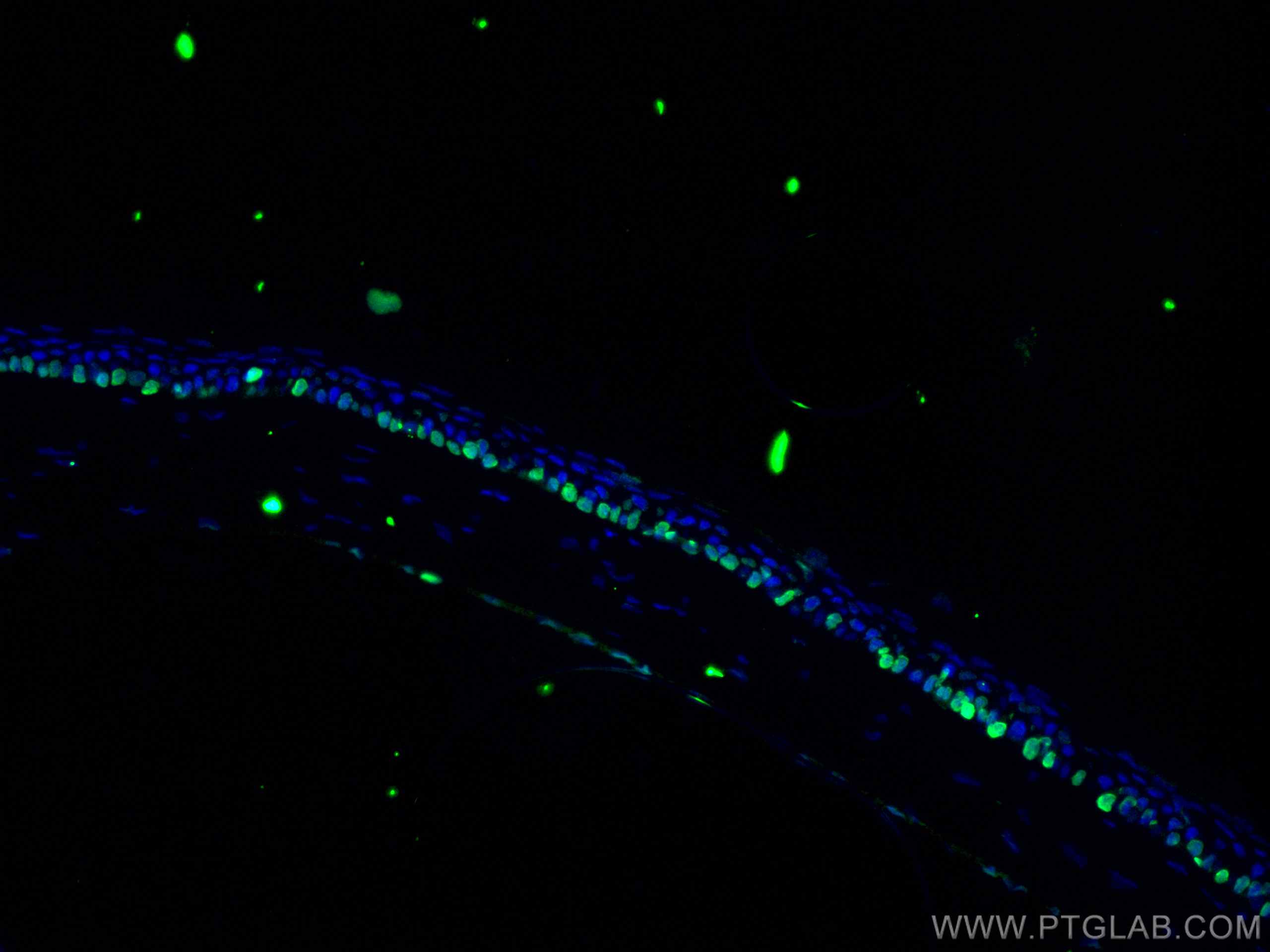 IF Staining of mouse eye using 11263-1-AP