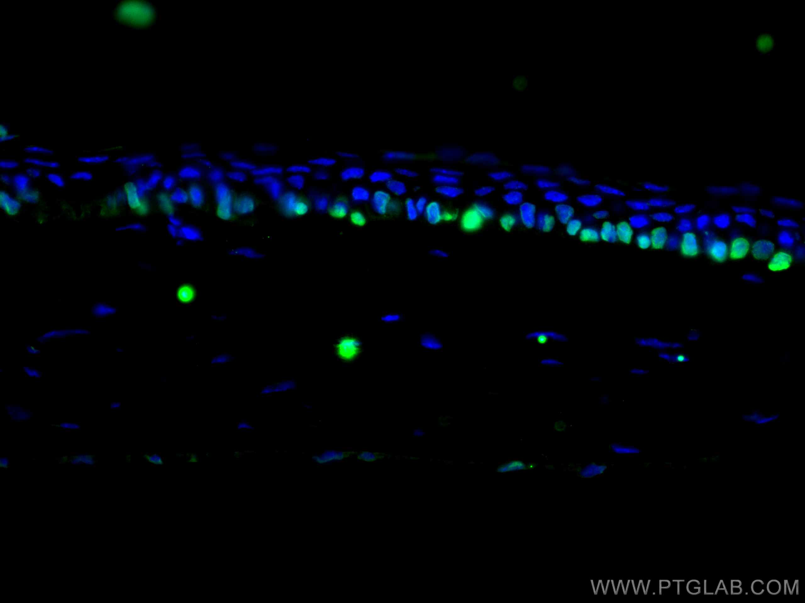 IF Staining of mouse eye using 11263-1-AP